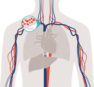 Sistemi za hemodinamski monitoring