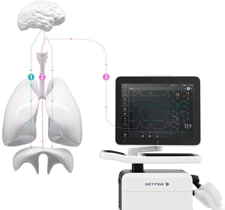 getinge medicinski respirator